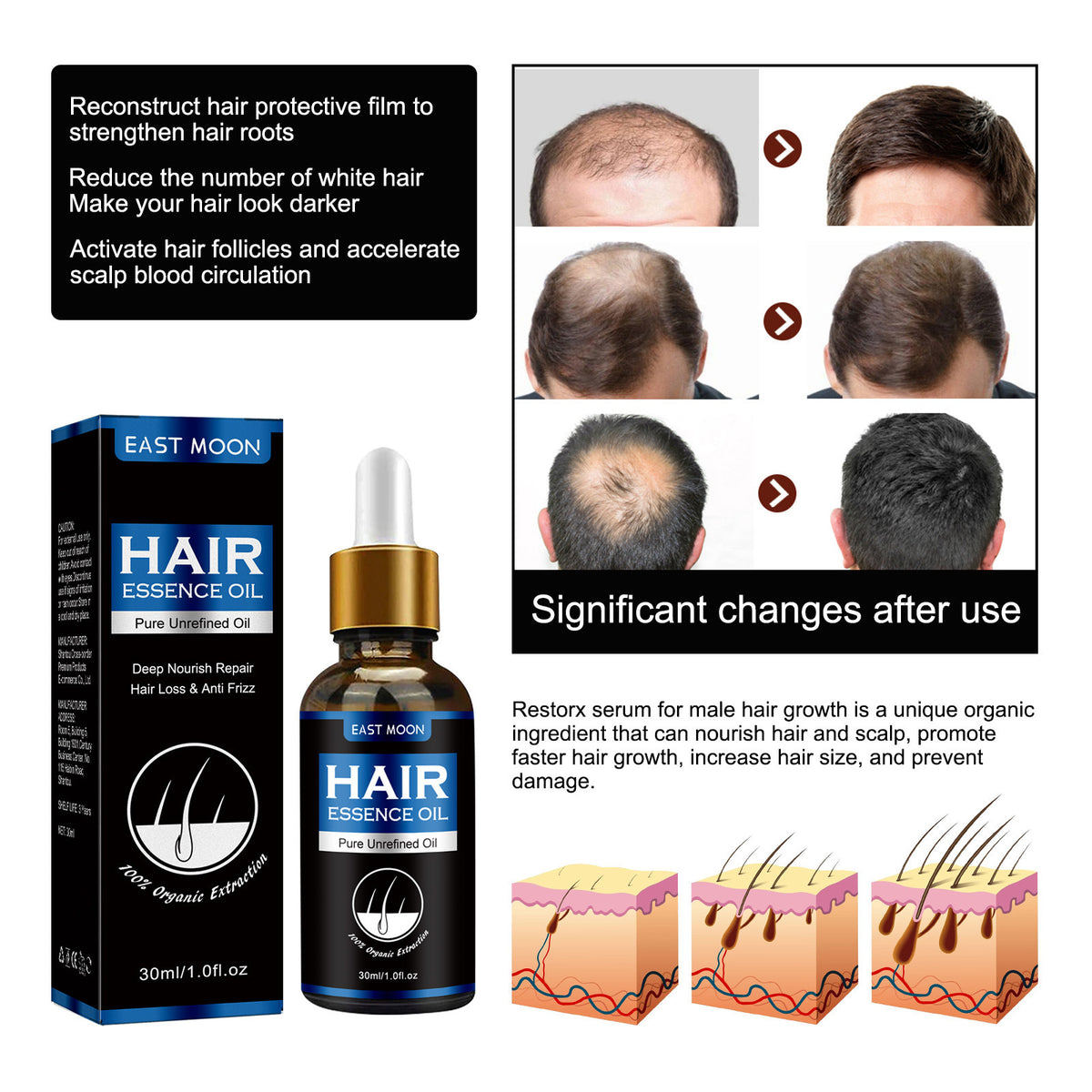 Dense Hair Essence Serum – Nutrition & Growth Support