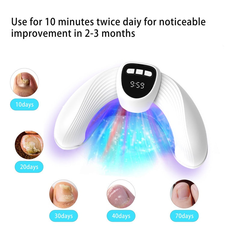 U-Shaped Portable Nail Phototherapy Machine