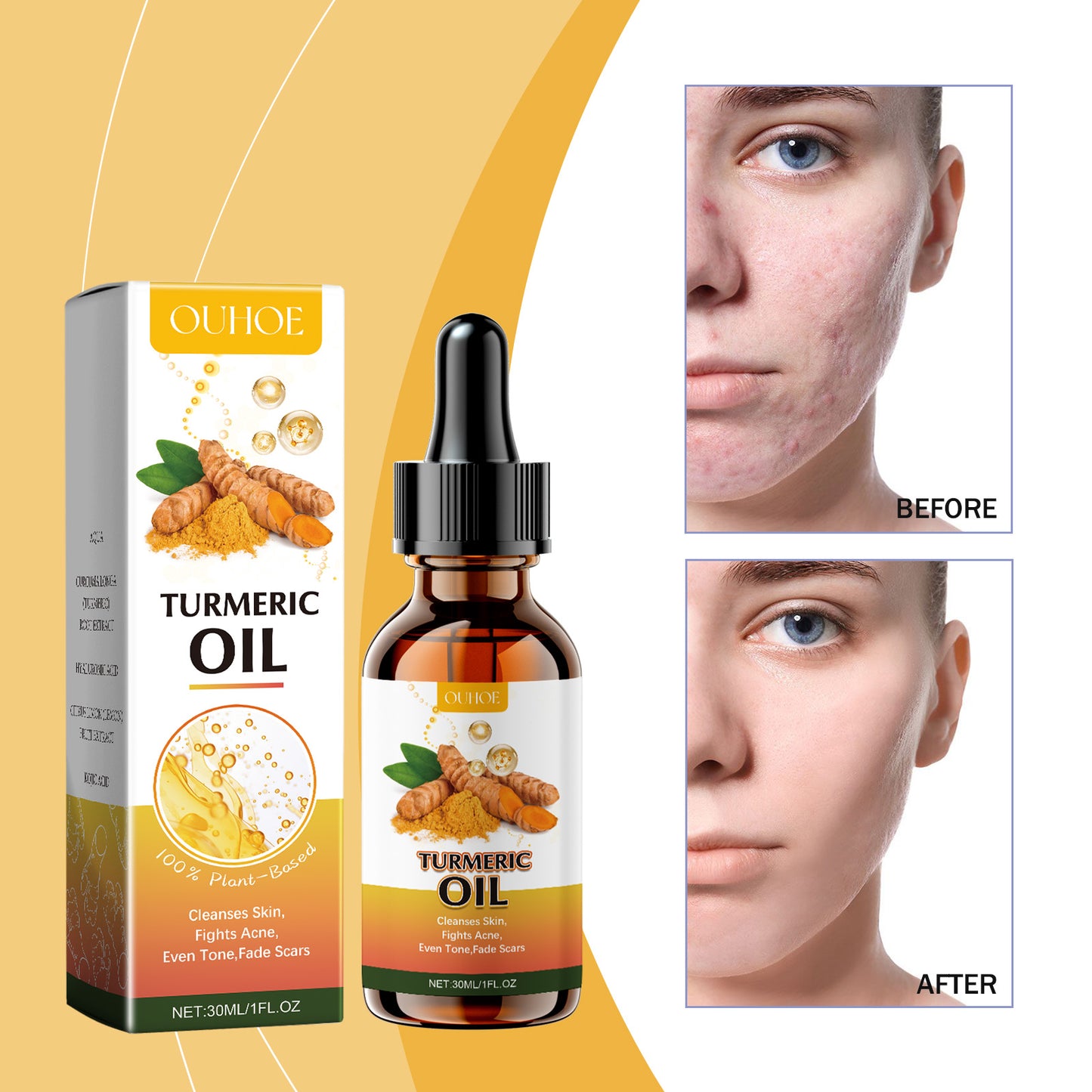 Turmeric Facial Cleansing Oil with Kojic Acid & Lemon Extract - 30ml