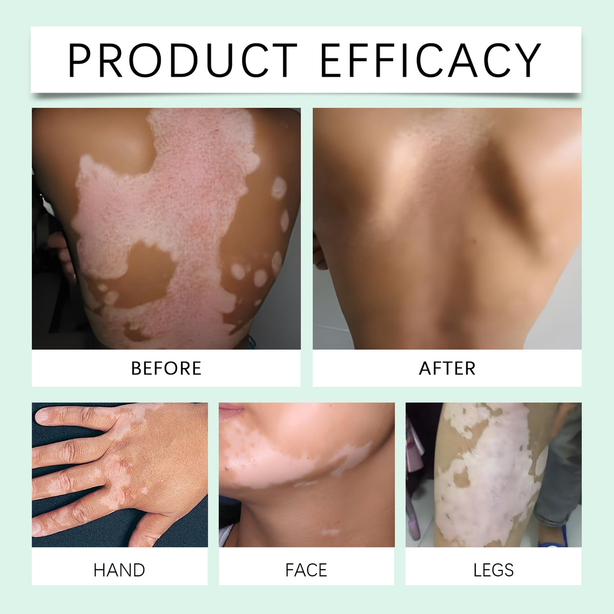 Body Skin Care Cream with Aloe & Mint 30g
