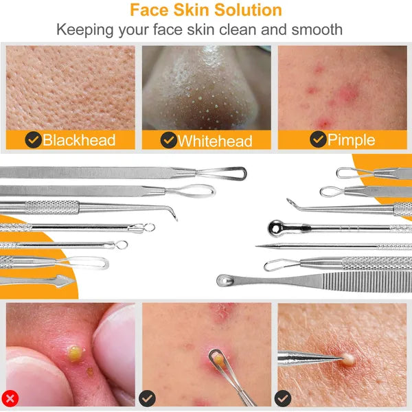 7-Piece Blackhead Remover Kit - Stainless Steel Pimple & Acne Extractor