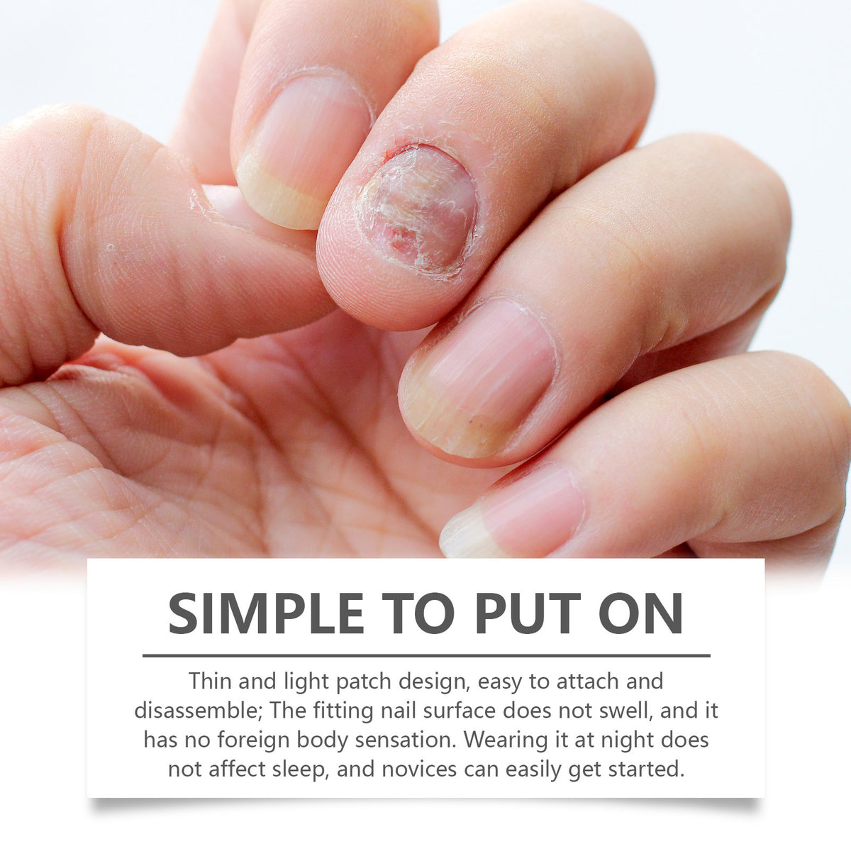 Nail Care Patches - 16 Pack