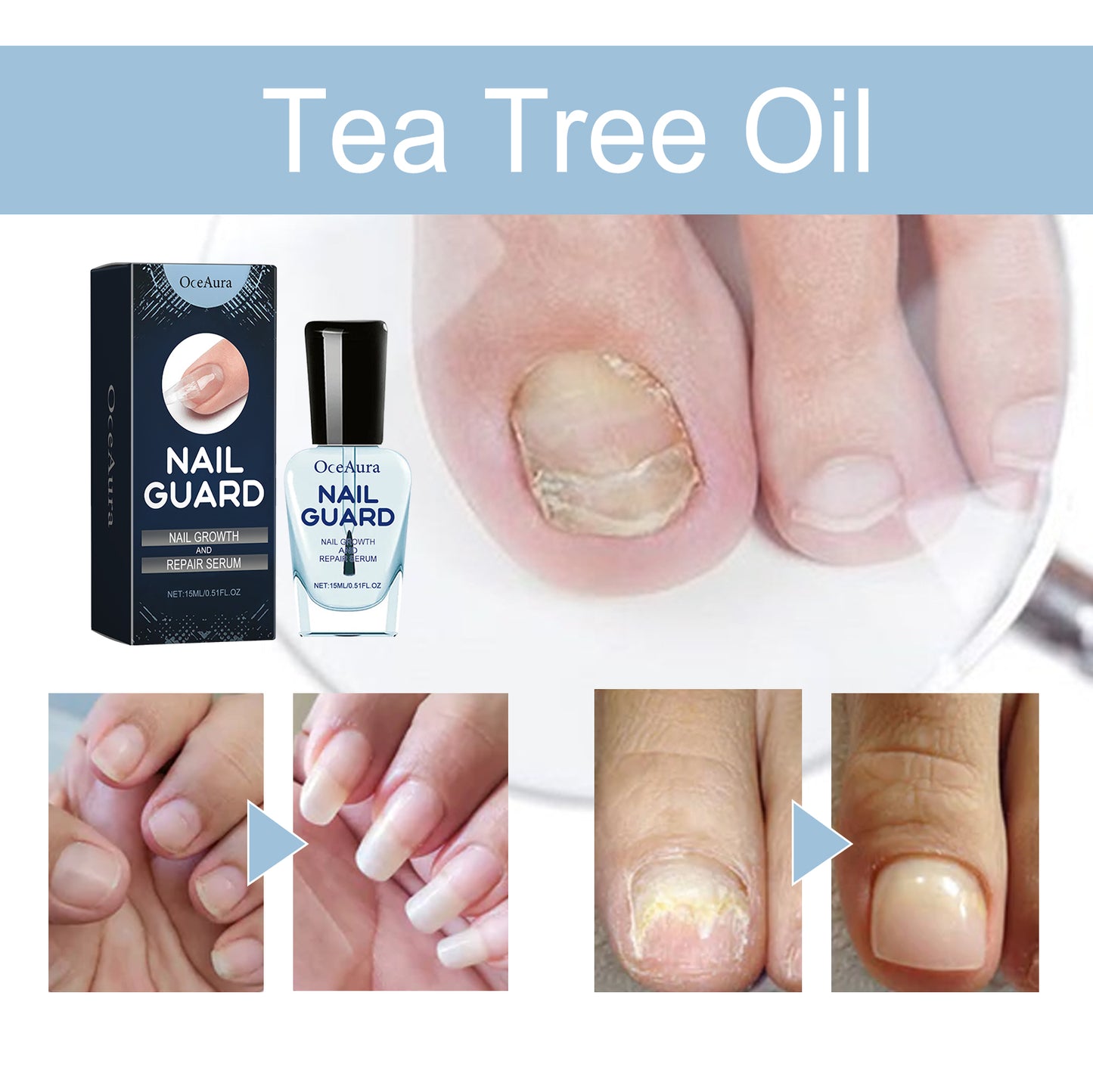 Nail Care Solution - Repair & Nourishing Treatment for Damaged Nails, 15ml