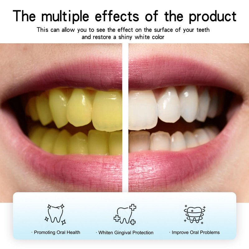 Powder for Stain Removal 30g - Dental Care