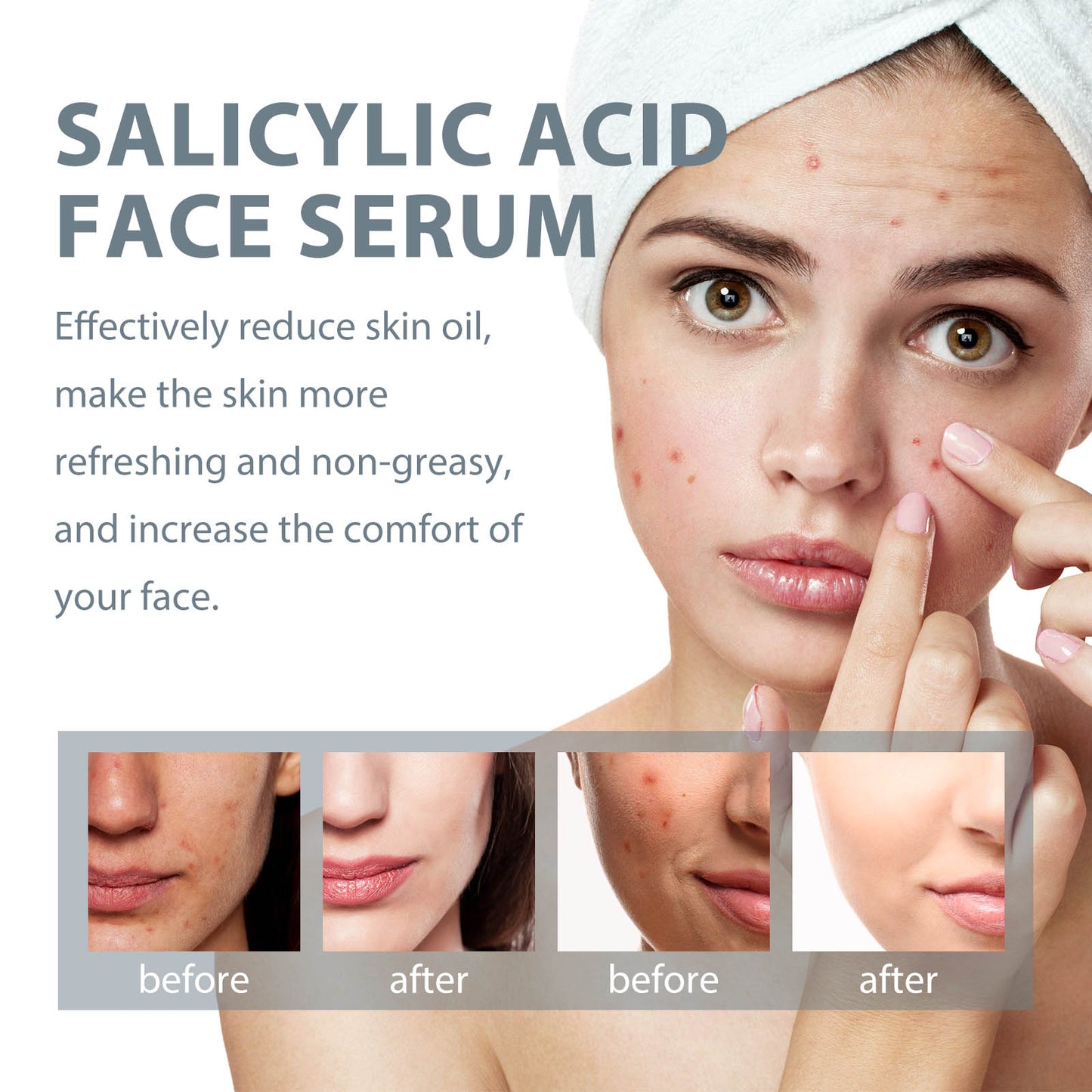 Salicylic Acid Facial Serum for Acne Repair and Oil Control - 30ml