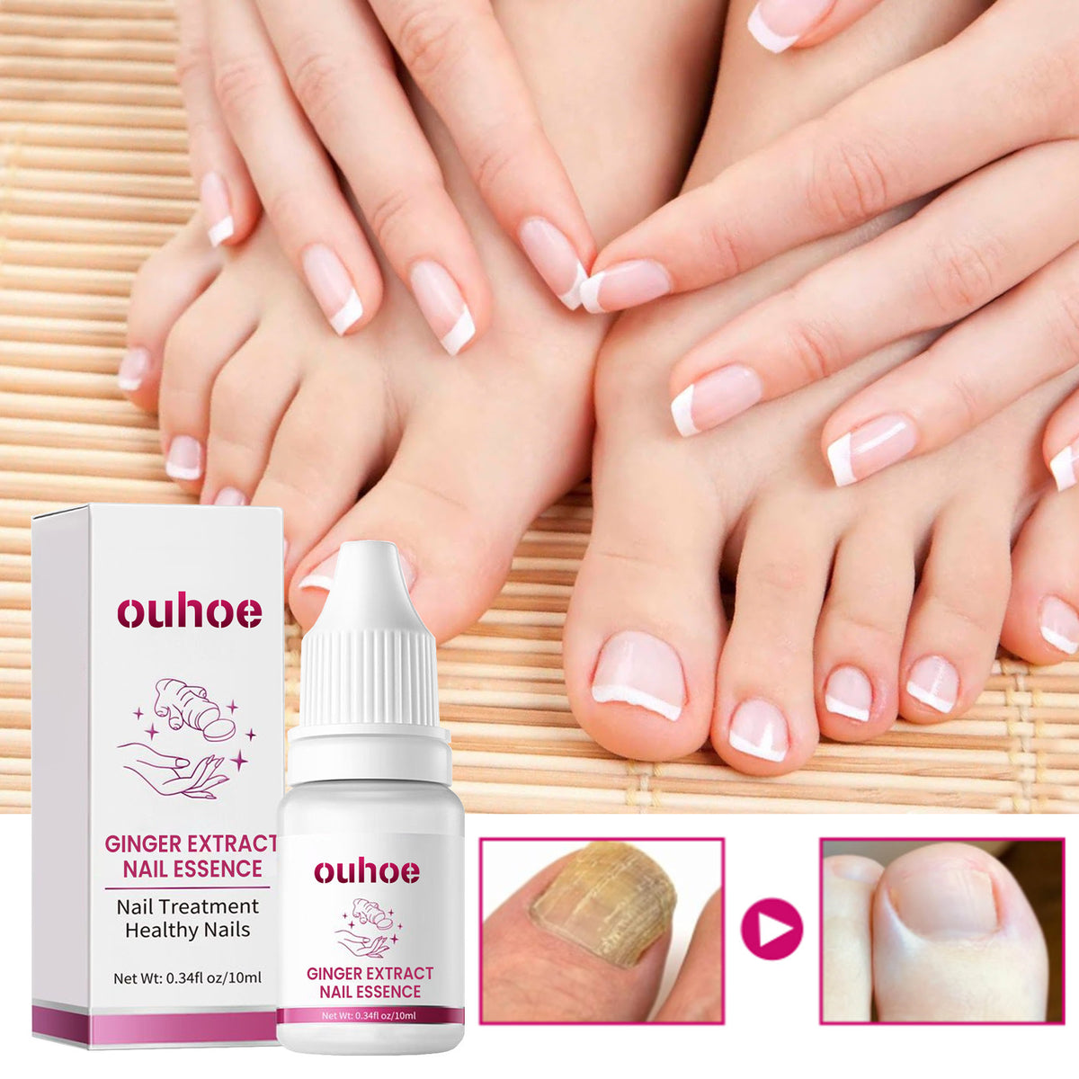 Nail Care Ginger Essence - Moisturizing Nail Treatment 10ml