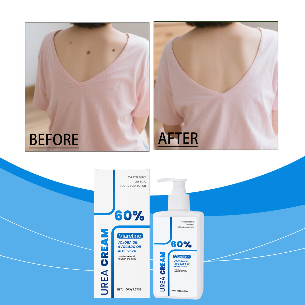 Urea Body Lotion – Hydrating Moisturizer, 100g