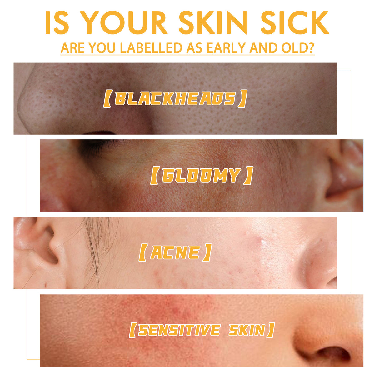 Honey Tearing Mask 60g Nourishing Moisturizing Blackhead Removal Acne Fading