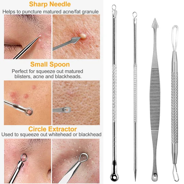 7-Piece Blackhead Remover Kit - Stainless Steel Pimple & Acne Extractor