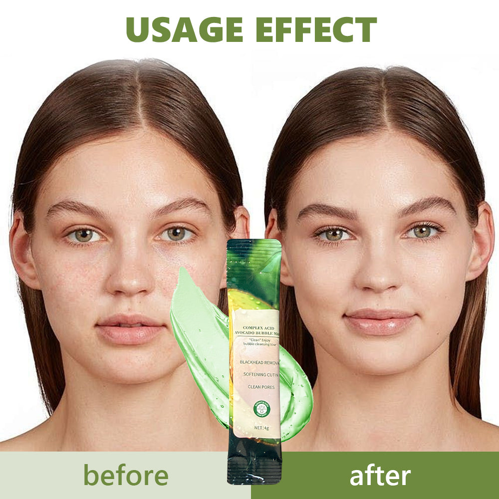 Hydrating Avocado Facial Sheet Mask - Nourishing Moisturizing Face Mask for All Skin Types