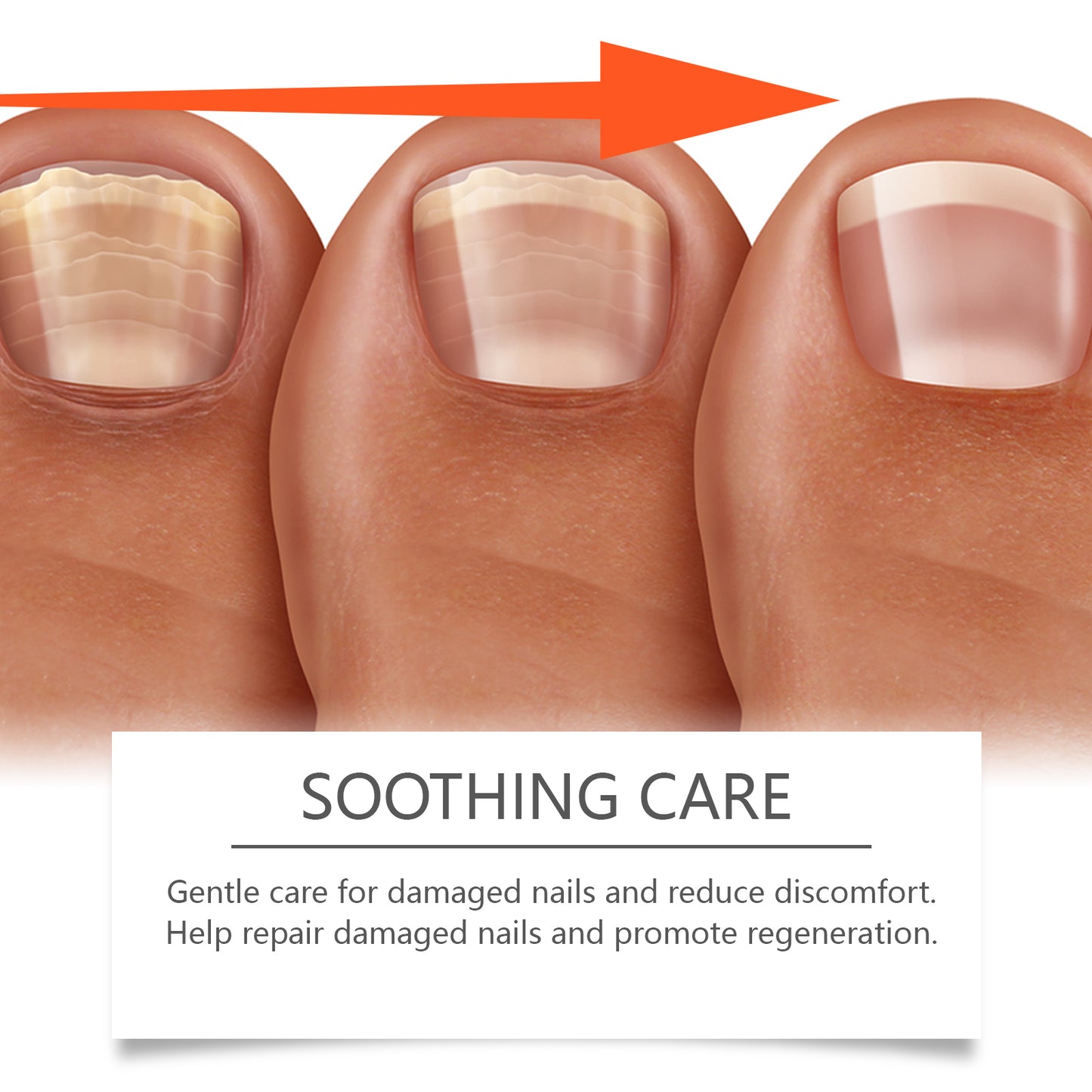 Herbal Nail Repair Solution - Nourishing Nail Growth Treatment