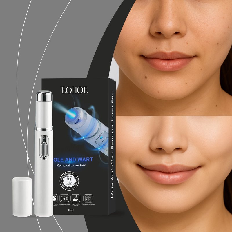 Skin Laser Pen for Face Skin Care - 1pc