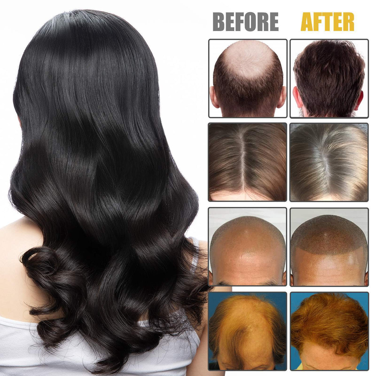 Ginger Hair Moisturizing Pomade - Anti-Itching & Dandruff Treatment 30g