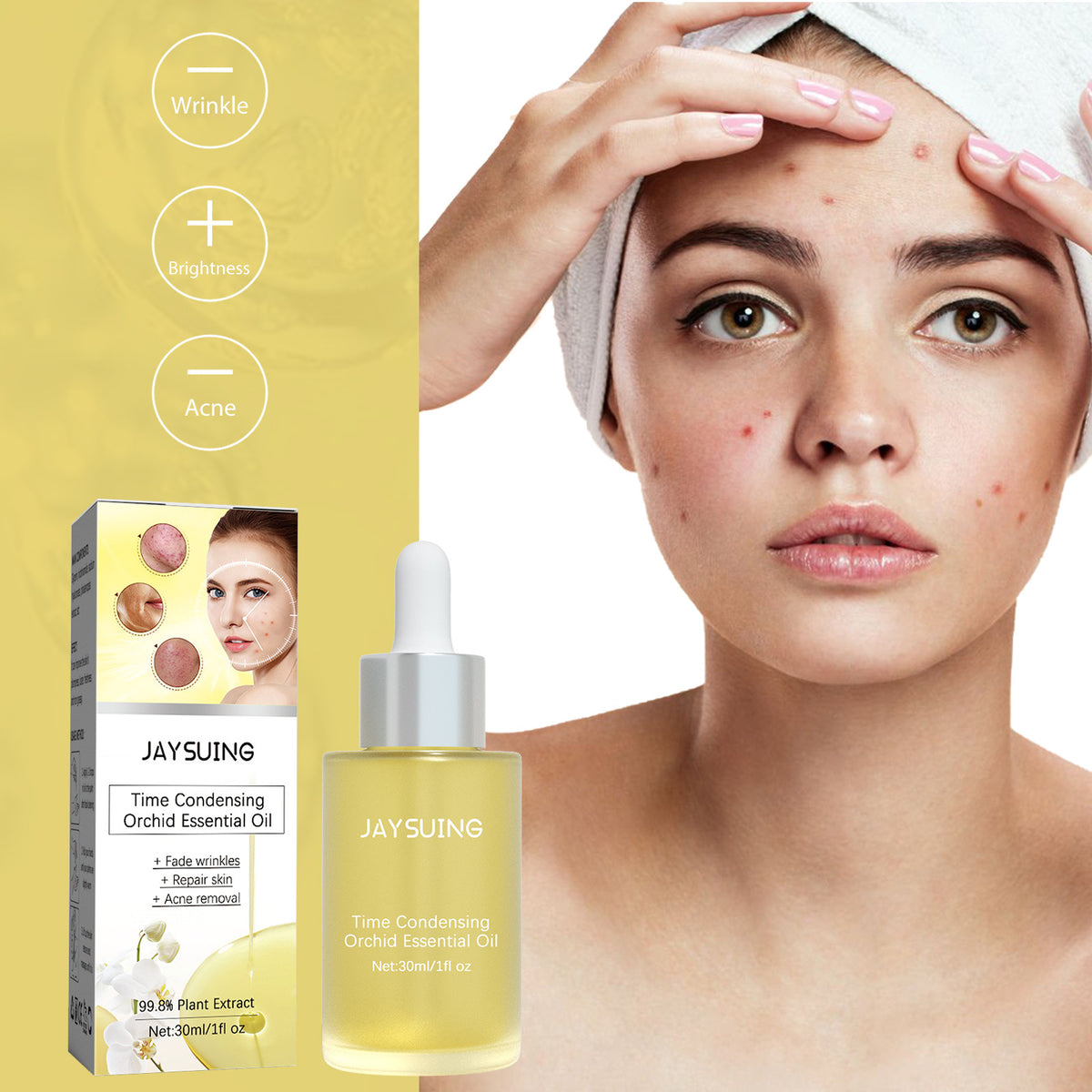 Acne Treatment Oil for Facial Cleansing & Brightening - 30ml