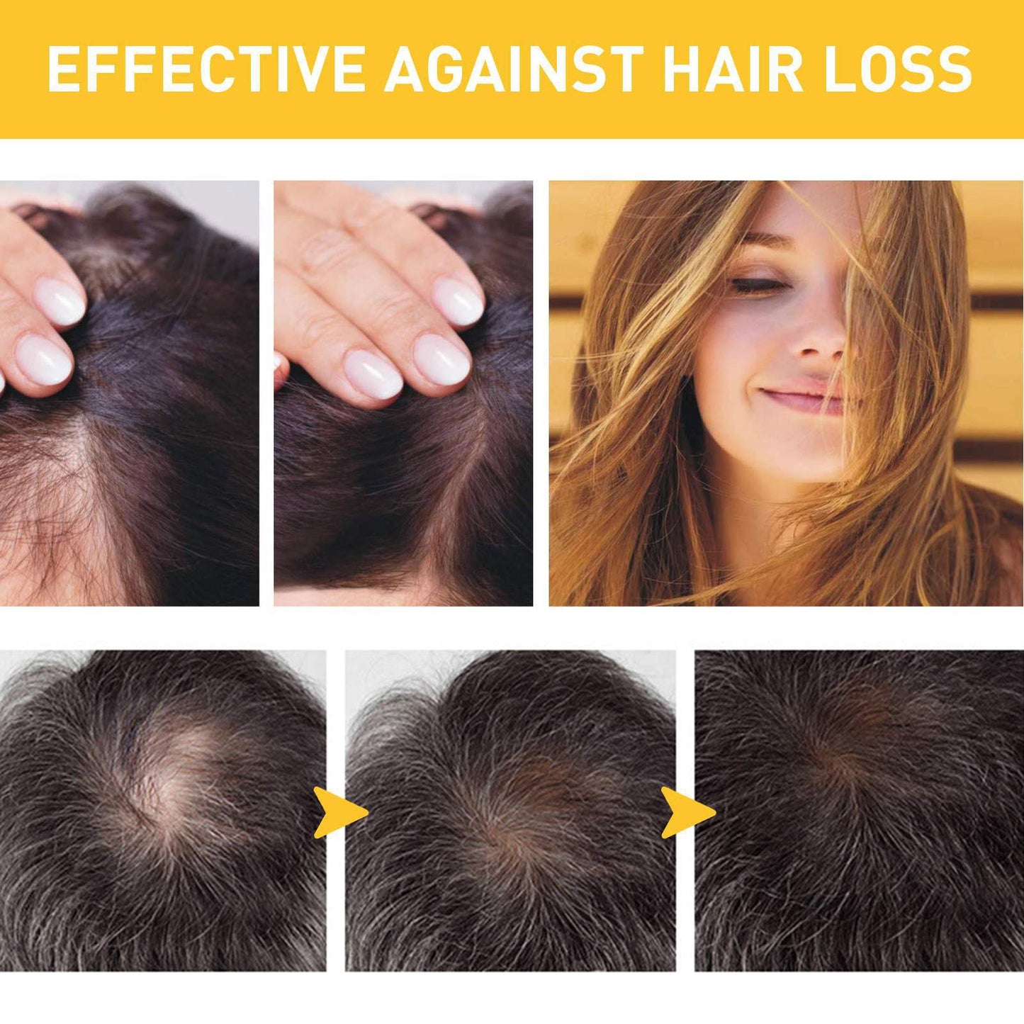 Ginger Hair Moisturizing Pomade - Anti-Itching & Dandruff Treatment 30g