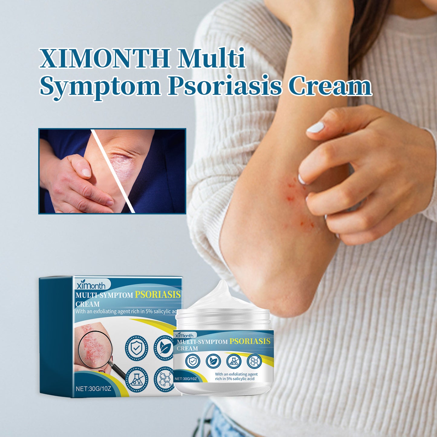 Psoriasis Relief Cream - Moisturizing Skin Repair for Hand, Foot & Body