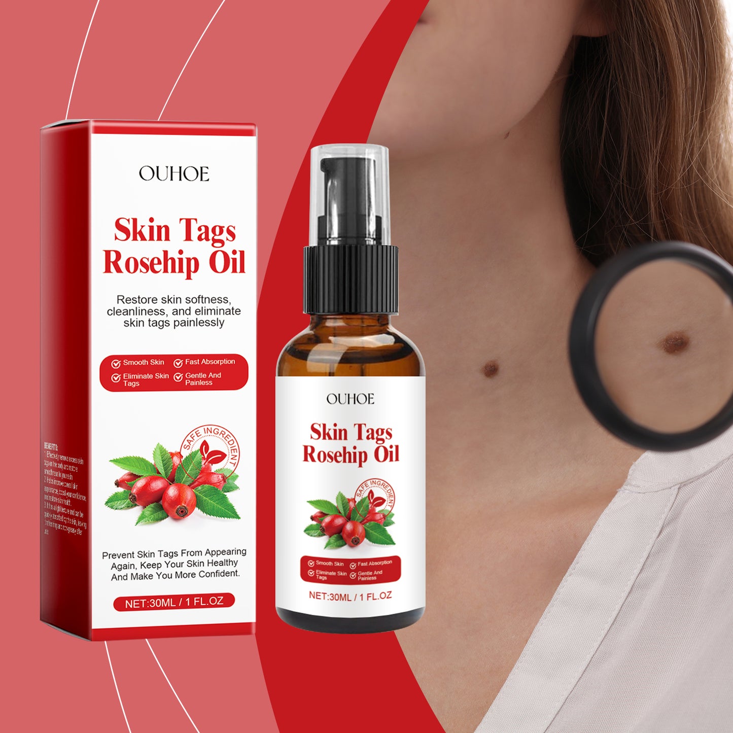 Rosehip Seed Skin Tag and Wart Repair Essence - 30ml