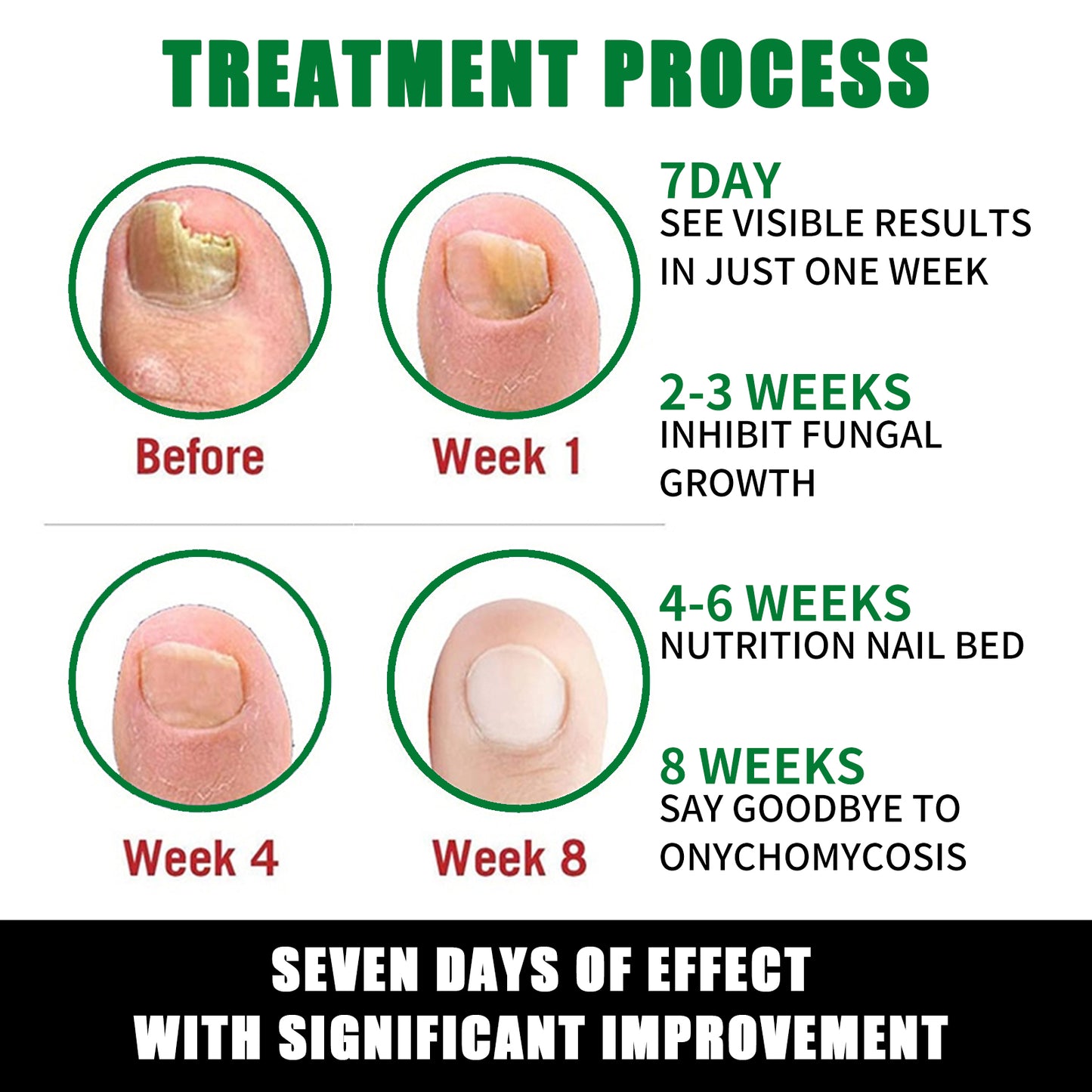 Ginger Nail Repair Solution for Fungal Treatment and Nail Restoration