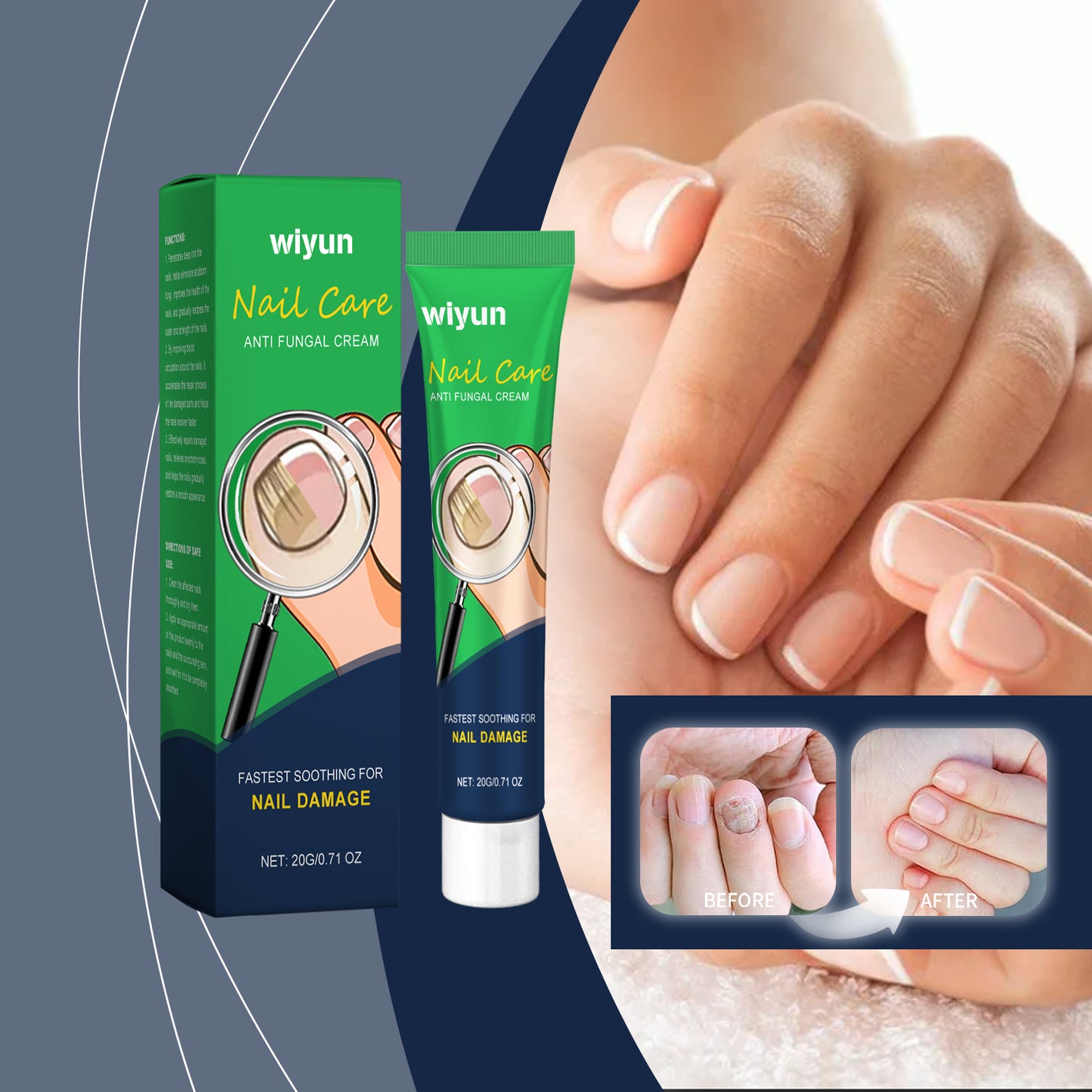 Nail Repair and Nourishing Cream with Vitamin E and Aloe for Damaged Nails