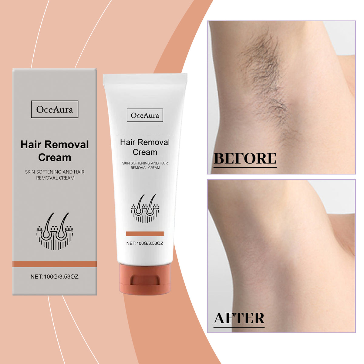 Gentle Hair Removal Cream - 100g