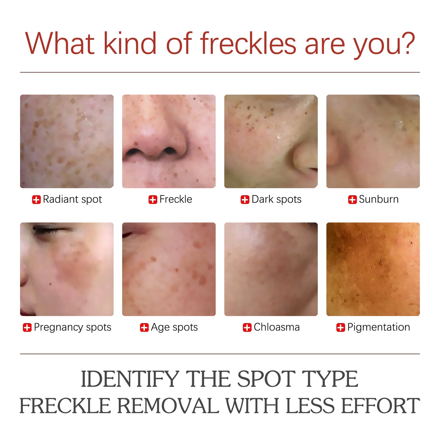 Pigment Correction Cream with Vitamin C & Retinol for Dark Spot Removal