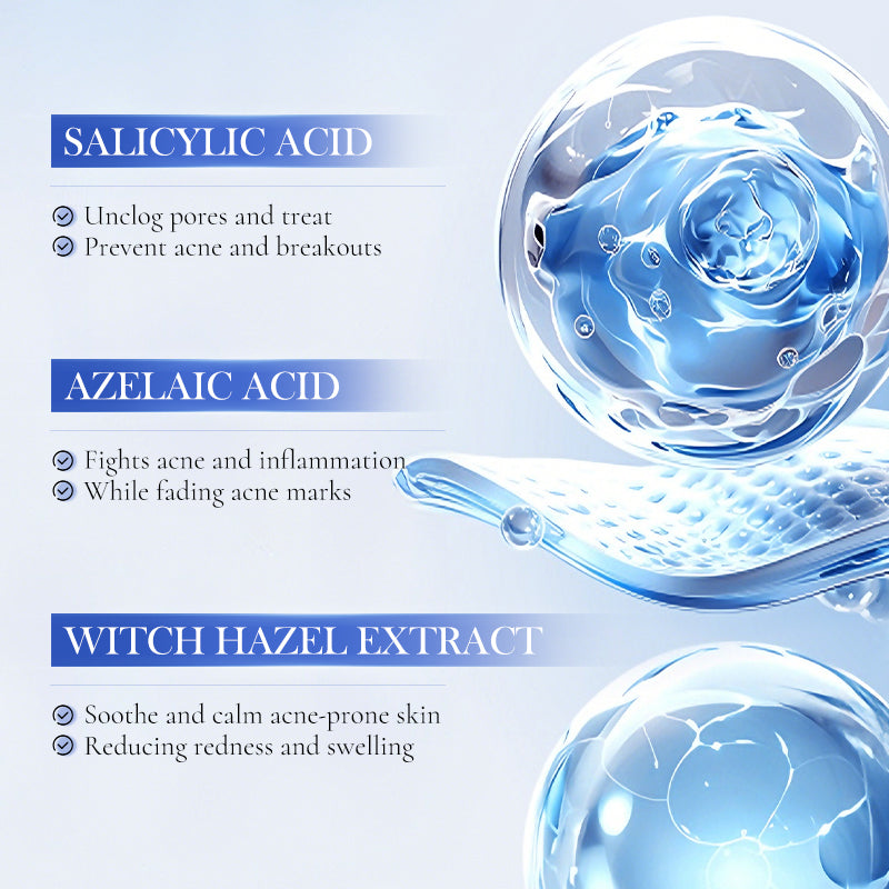 Acne Spot Treatment Serum - 10ml Oil Control & Anti-Inflammatory Skin Care