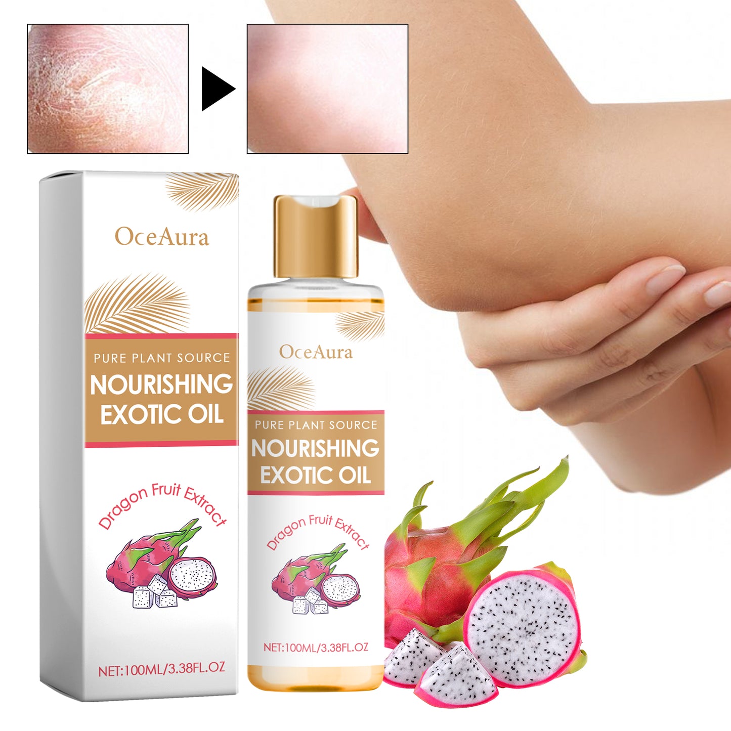 Exotic Nourishing Body Oil - 100ml Fractionated Coconut Oil Moisturizer