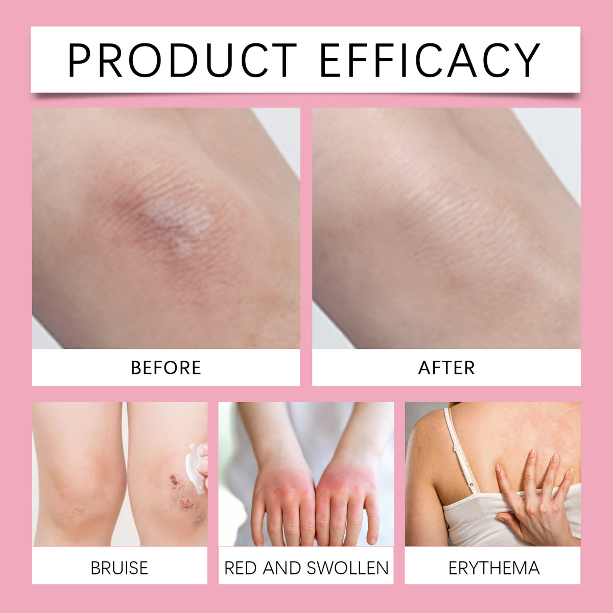 Body Anti Friction Moisturizing Stick 40g