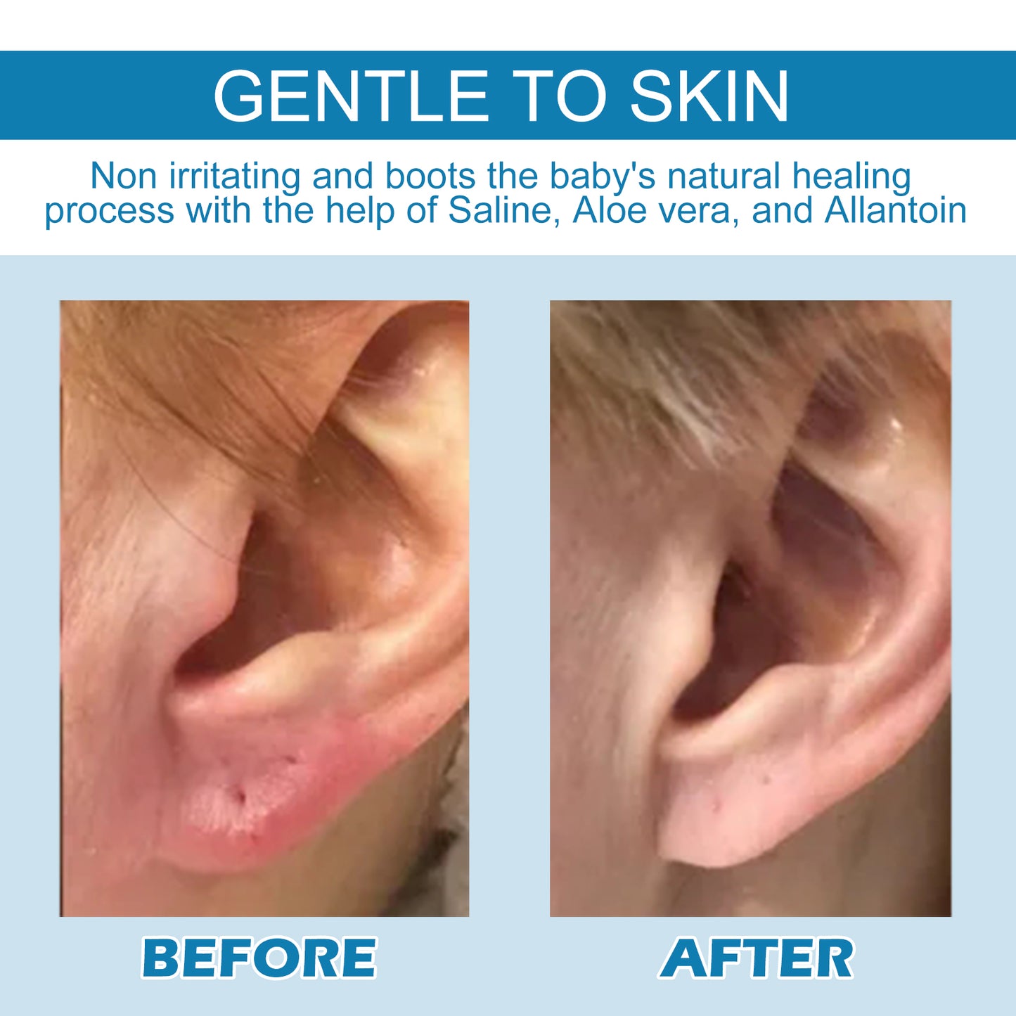 Piercing Repair Drops for Ear Care - Soothing Solution for Bumps & Scars 30ml