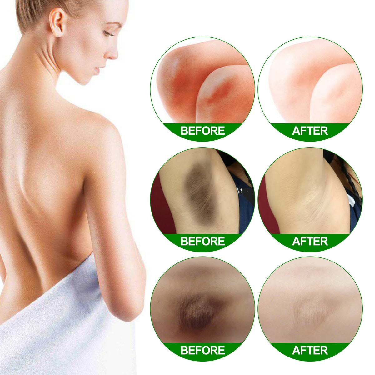 Underarm Brightening Cream 10ml