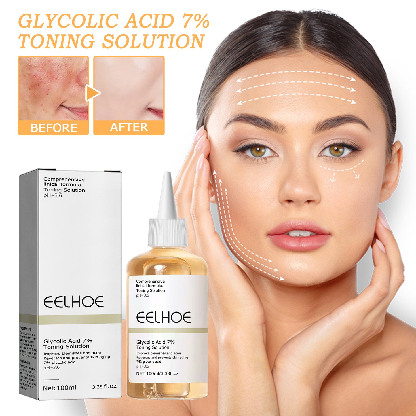 Glycolic Acid 7% Facial Lotion for Acne, 100ml - Moisturizing & Exfoliating