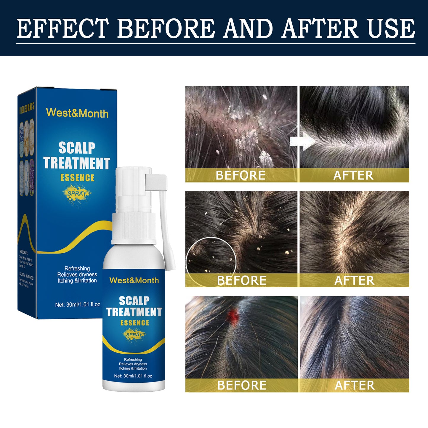 Hair Follicle Damage Repair Spray for Hair Root Care - 30ml