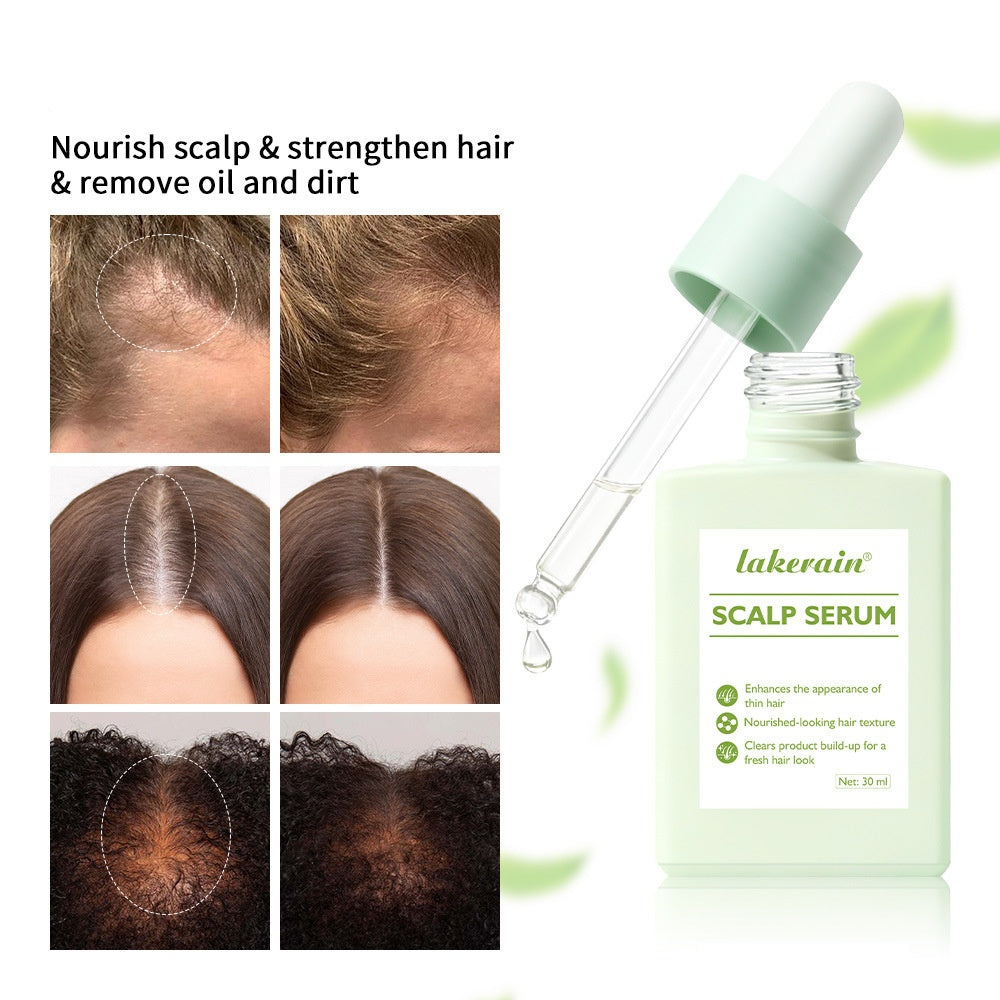 Scalp Serum - 30ml Hair Treatment Essential Oil