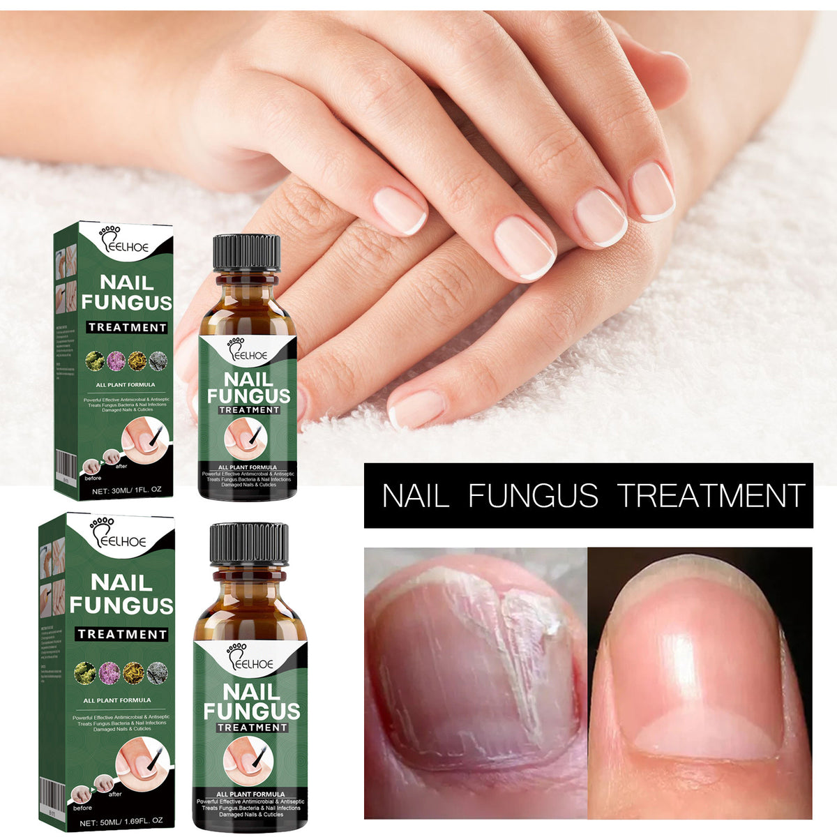 Nail Care Liquid for Cleaning Fingernails and Toenails - 30ml & 50ml Options