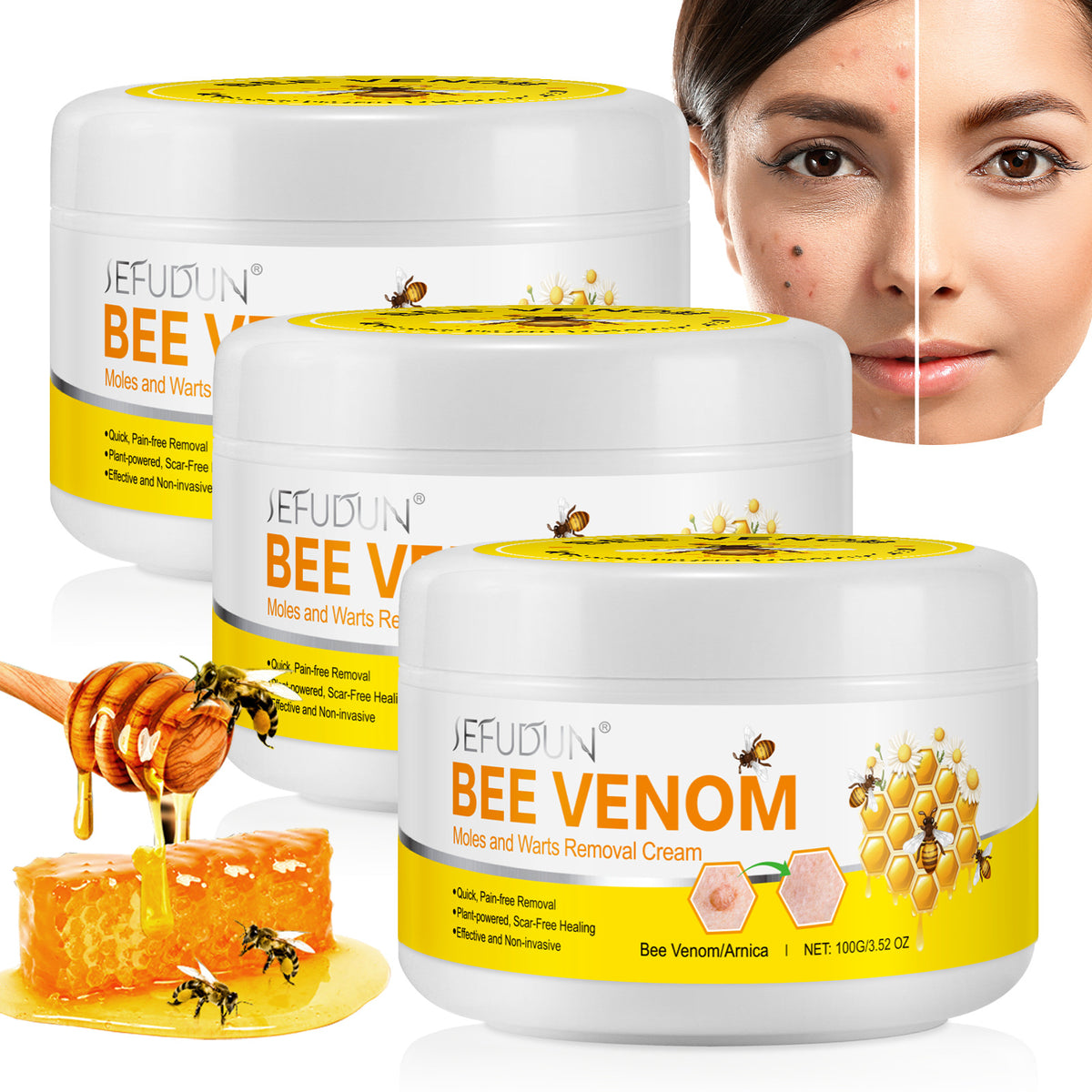 Exfoliating Smooth Skin Moles Wart Cream