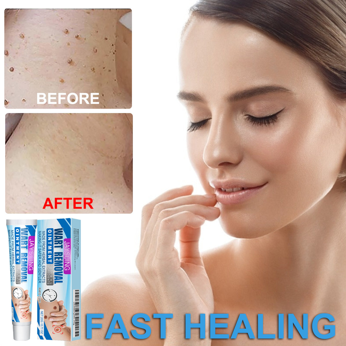 External Body Skin Care Paste - Universal, 20g Natural Emulsifiable Treatment