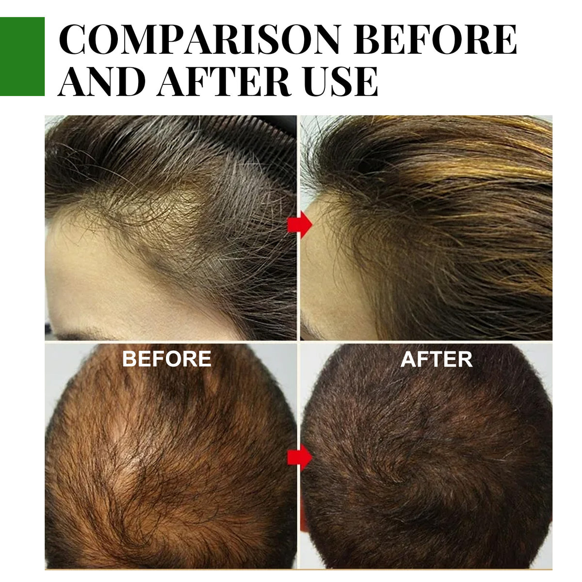 Rosemary Hair Growth Oil - Anti-Hair Loss Essential Oil 30ml