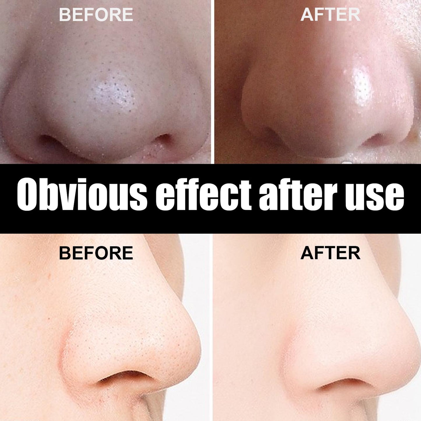 10 Pcs Blackhead Remover Nose Strips - Deep Pore Cleansing & Oil Control