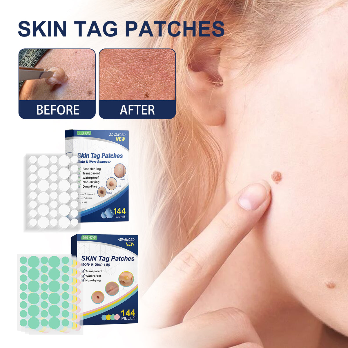 Skin Smoothing Patches 144PCS for Skin Tag & Mole Removal - 36PCS x 4 Sheets