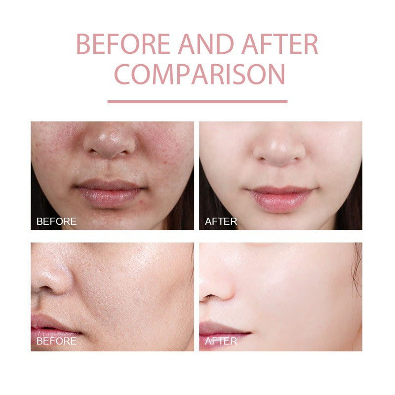 Nicotinamide Hydrating Skin Care Solution for Moisturizing - 30ml