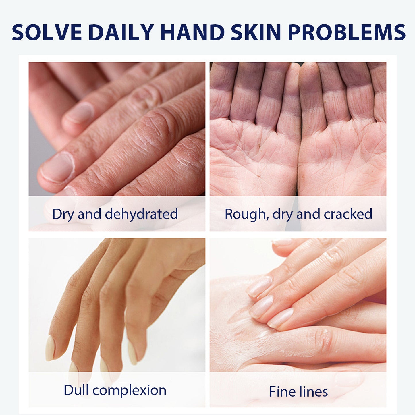 Aloe Vera Hand Care Gel - Hydrating Moisturizer for Dry & Cracked Skin