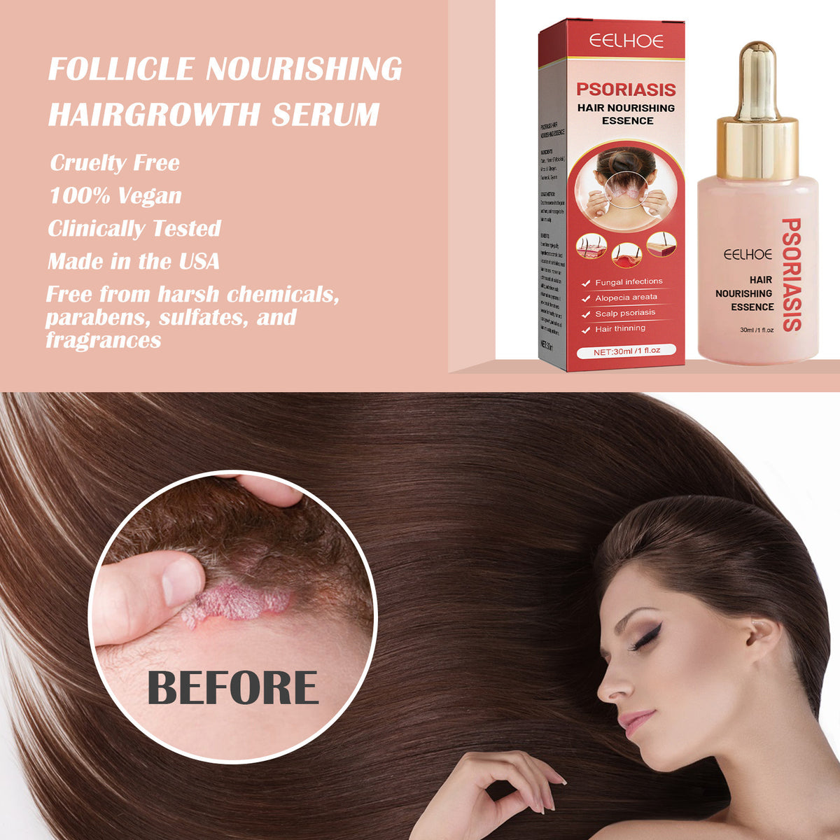 Scalp Cleansing Serum 30ml - Oil Control & Flake-Free