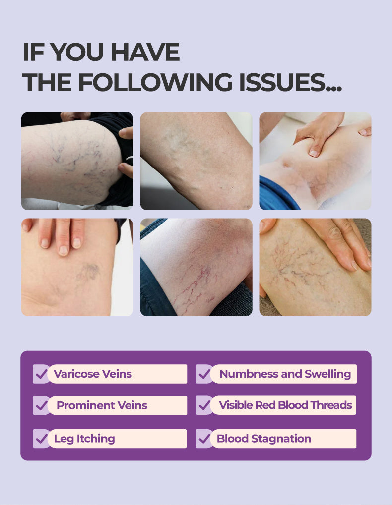 Varicose Vein Relief Cream with Centella Asiatica Root Extract