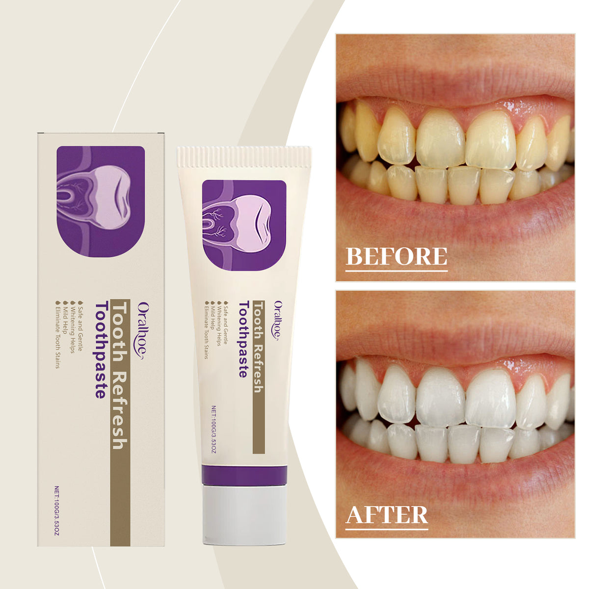Whitening Repair Toothpaste 100g - Oral Care for Bright Teeth