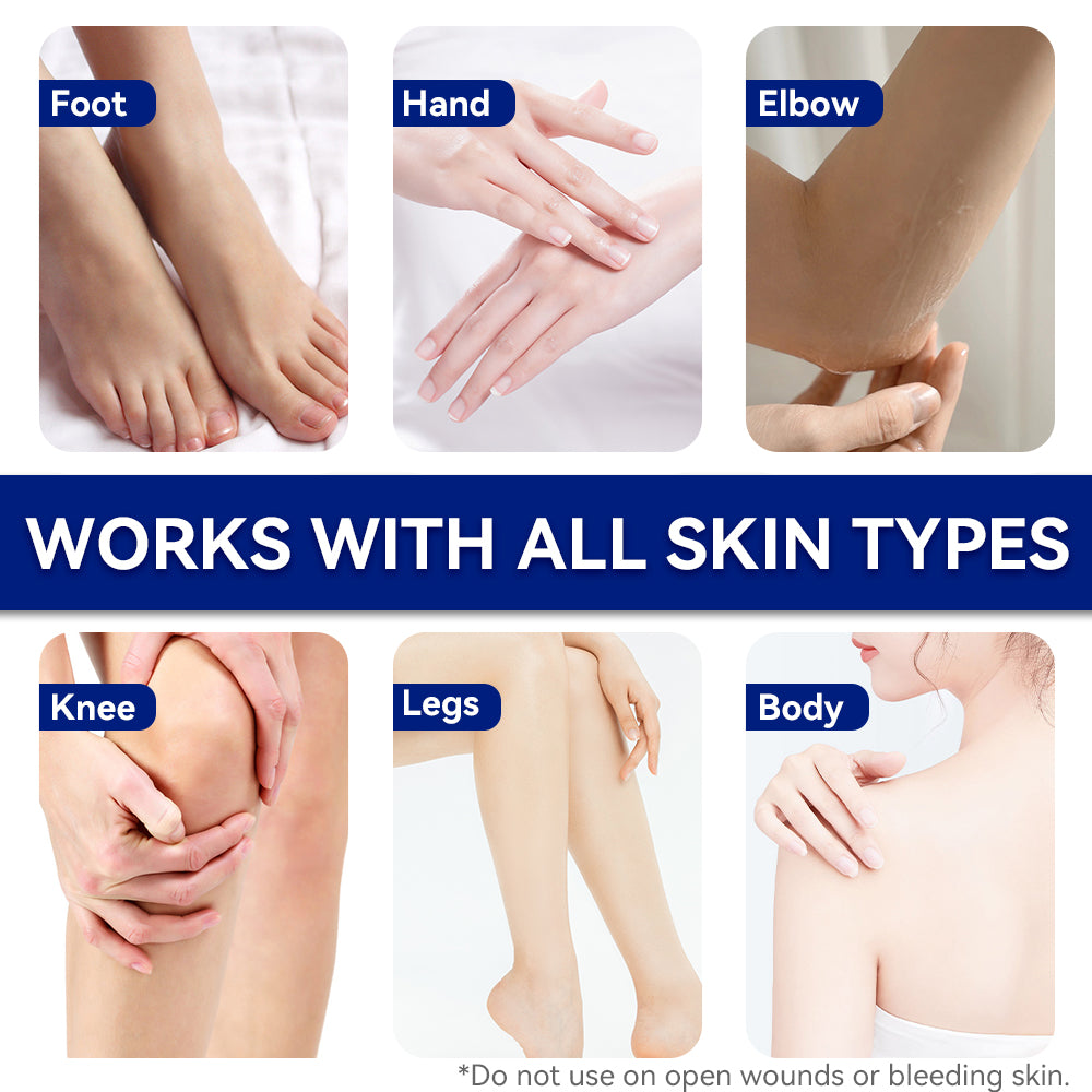 Urea Moisturizing Body Lotion with Vitamin E for Dry Hands and Feet