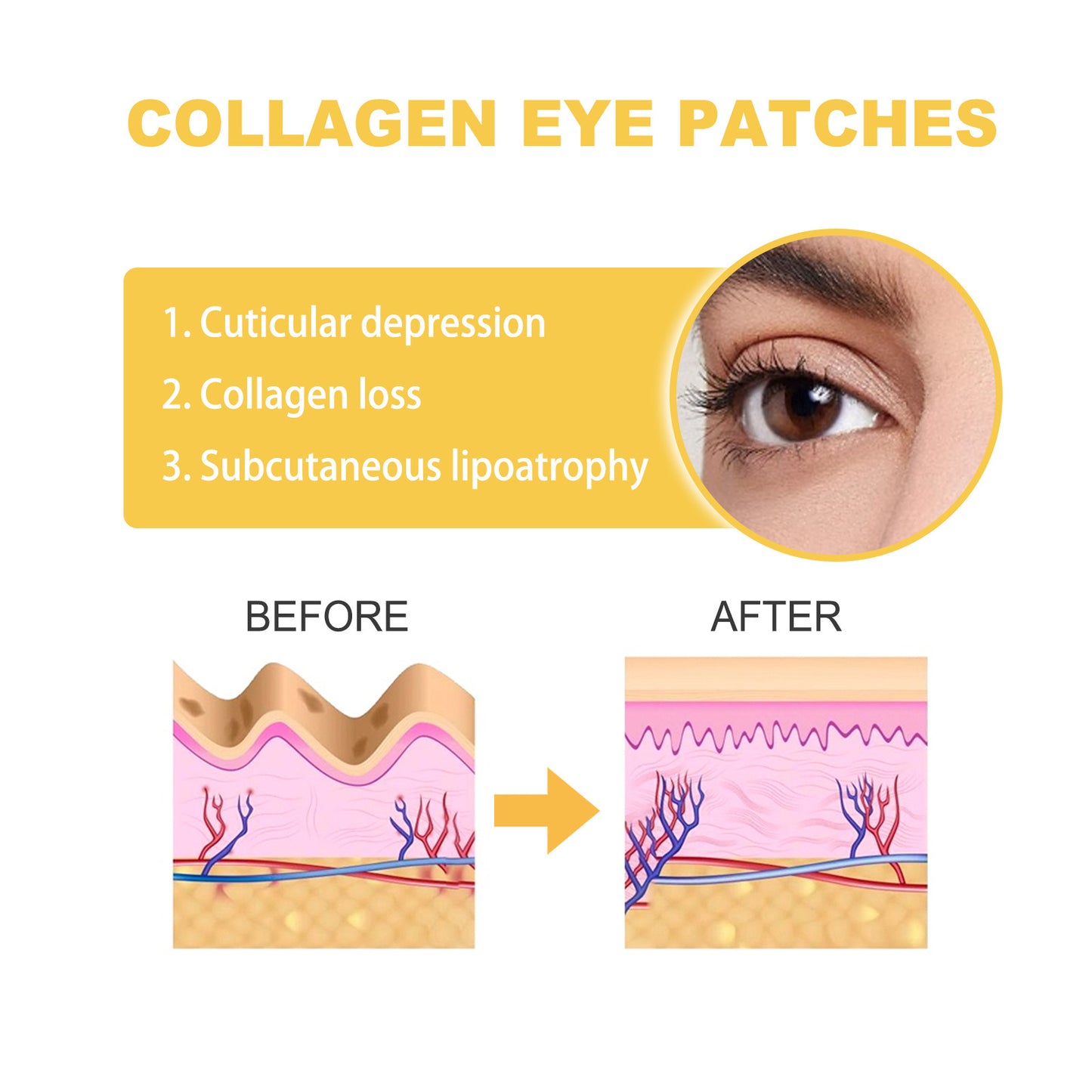Collagen Eye Mask Patches for Wrinkle & Dark Circles - 10 Pieces