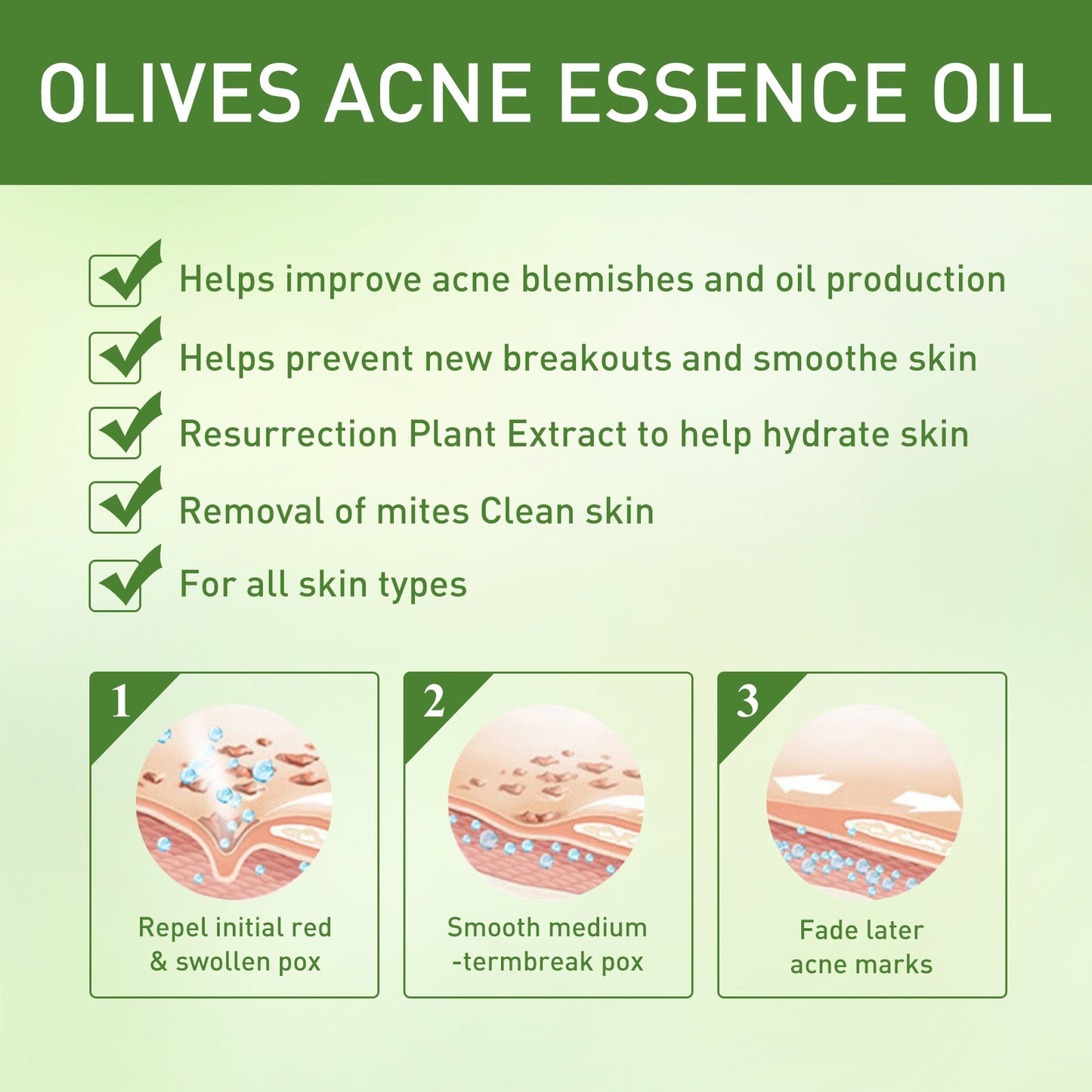 Acne Face Oil - Gentle Moisturizer for Acne Marks & Pit Repair 30ml