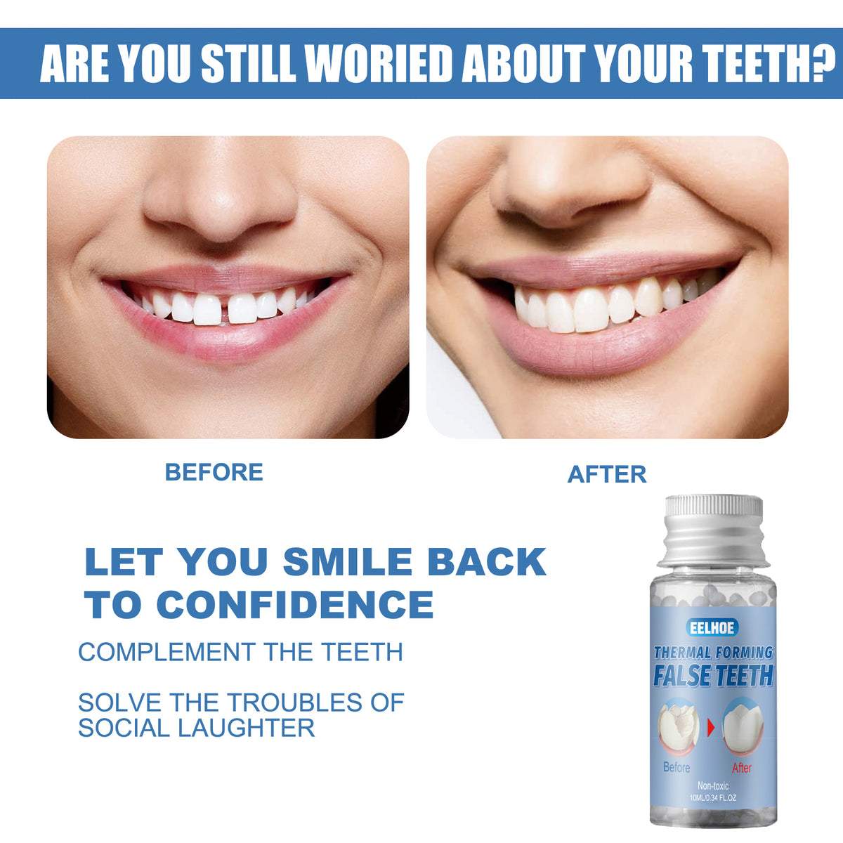 Moldable Dental Putty - Temporary Tooth Filler 30ml