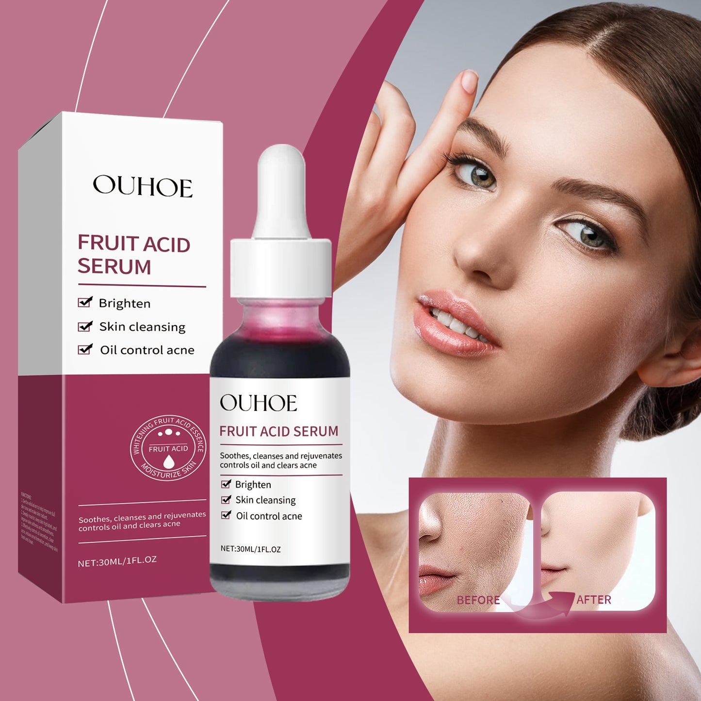 Fruit Acid Purifying Serum - Gentle Exfoliating Facial Essence 30ml