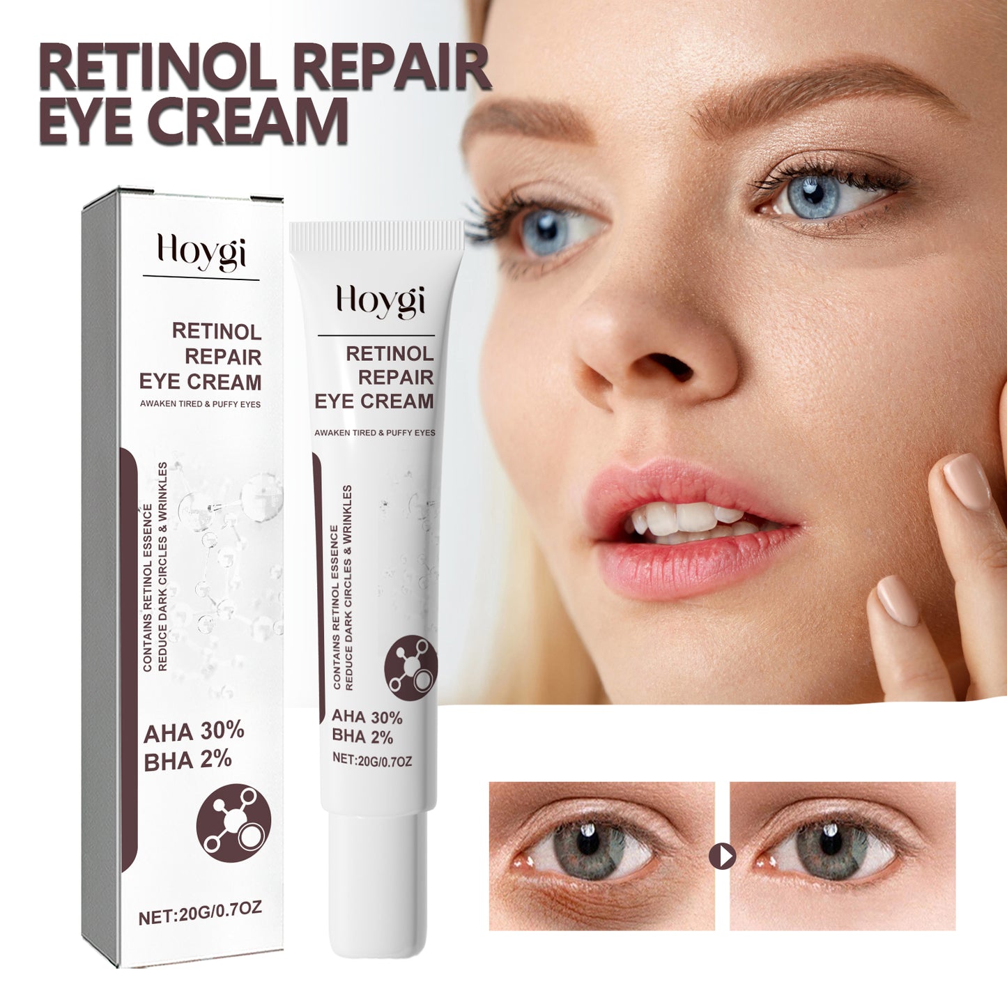 Retinol Repair Eye Cream for Fine Lines, Wrinkles & Dark Circles